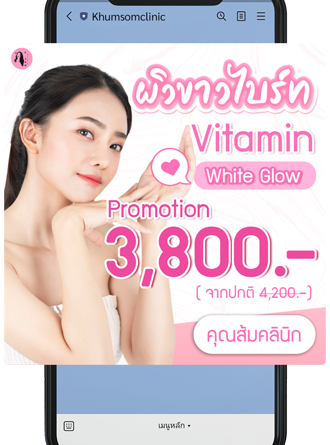 ตัวอย่างริชเมสเสจ (Rich Messages)